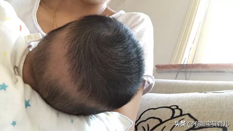 宝宝头发问题,宝宝头发少头发黄怎么办