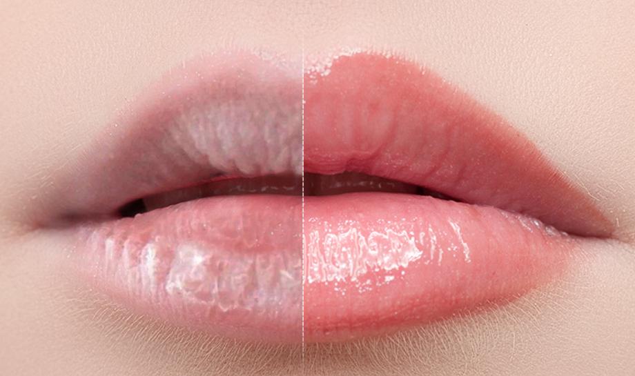 什么除螨皂祛后背痘痘好,用除螨皂洗脸痘痘会越长越多吗