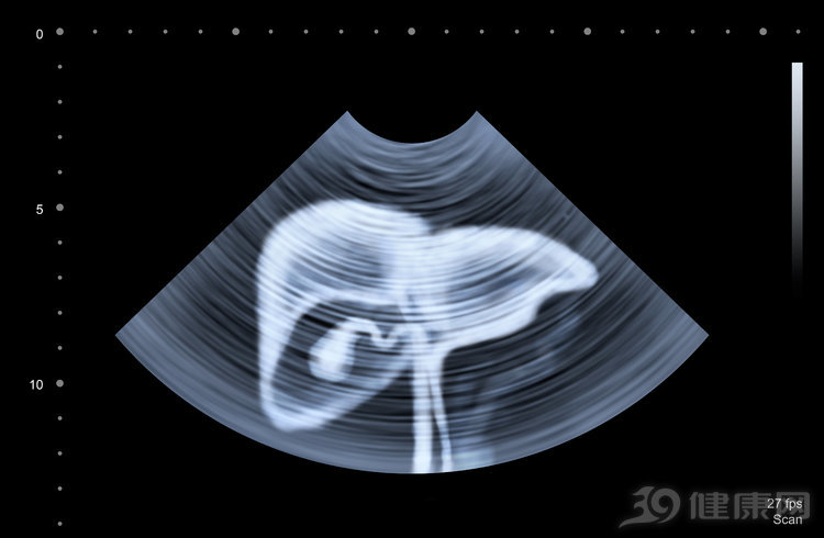 丙肝能治好吗是怎么治疗的,丙肝能完全治愈吗