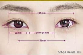 开眼角不对称可以免费修复吗,做开眼角后用什么祛疤