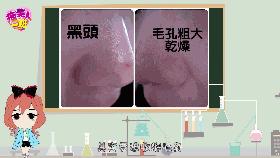 去脸上的麻子的方法,脸上毛孔变大出油长小痘