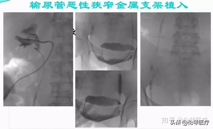 瑞金医院王忠敏,瑞金医院王忠敏简介