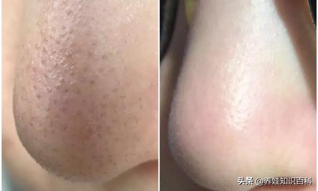 天天熬夜带娃瘦了,天天熬夜带娃也不见瘦