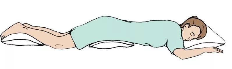 ards急性呼吸窘迫综合征分型,呼吸窘迫综合征诊疗指南