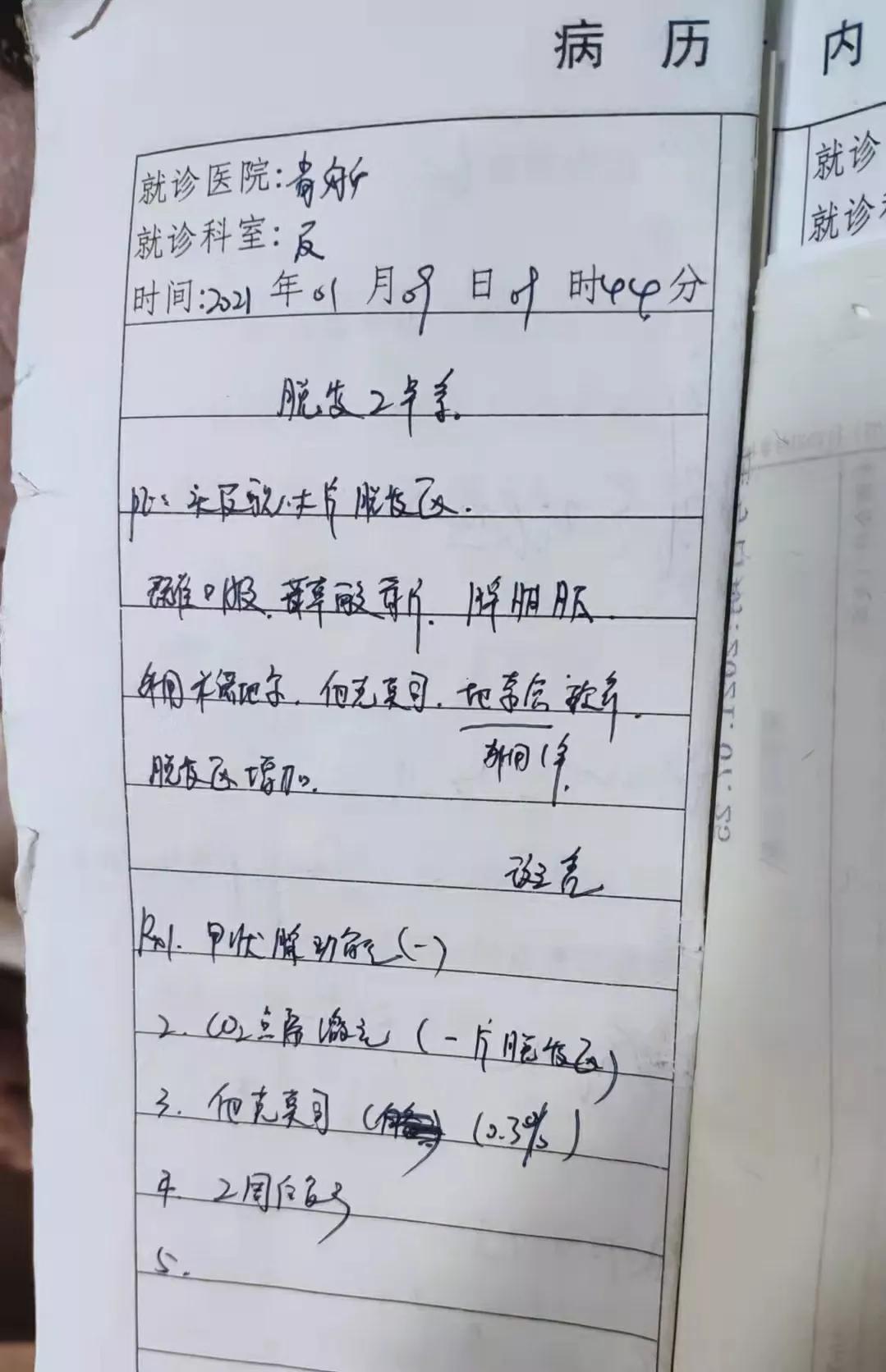 斑秃属于疑难杂症么,斑秃治疗中越来越严重怎么回事