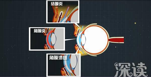 女子熬夜玩手机眼瞎的视频,女子熬夜玩手机眼瞎