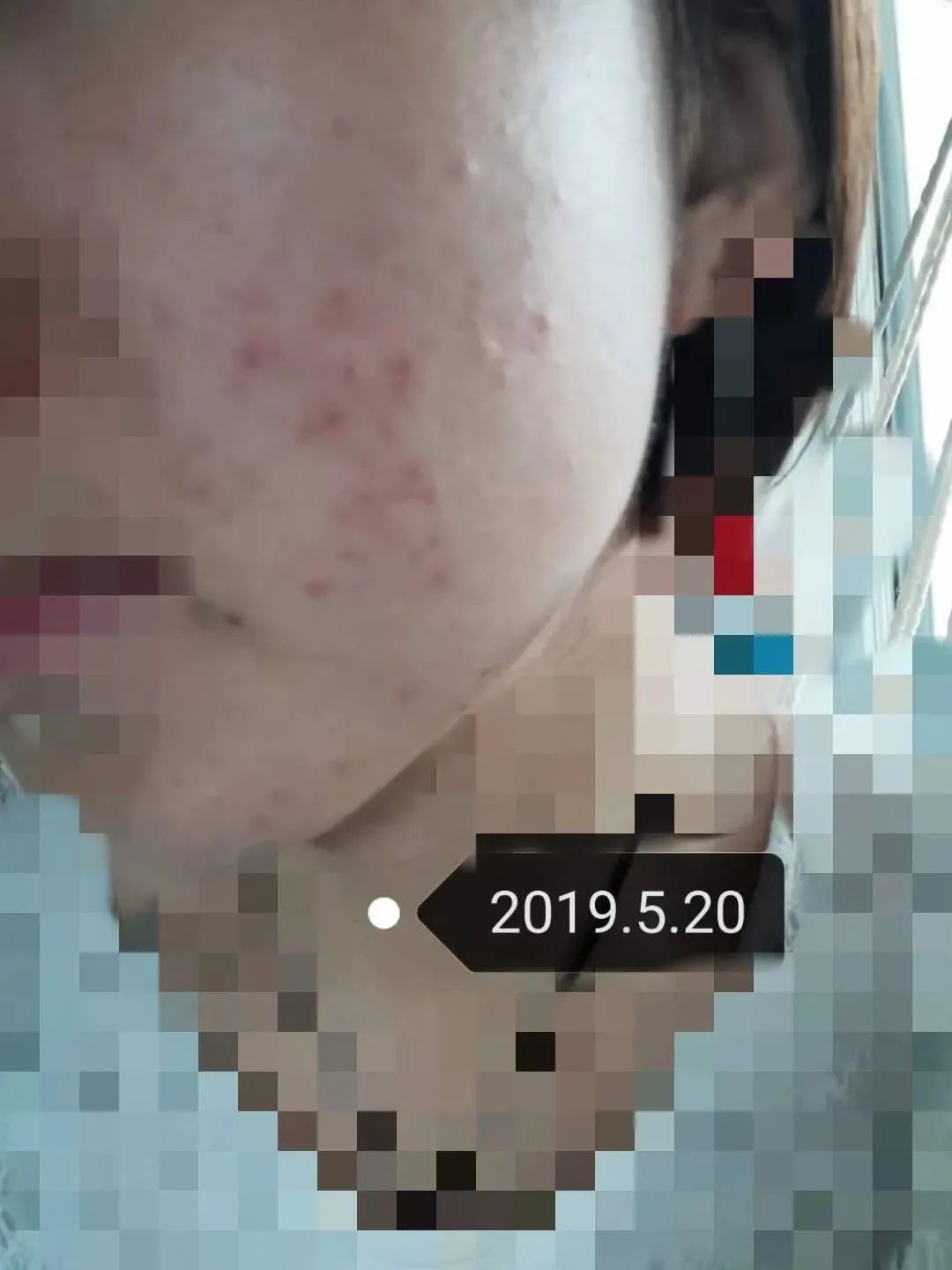 用大牌化妆品真的不会老吗,用大牌护肤品皮肤还是不好