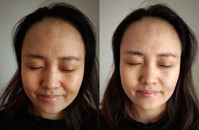 40岁女性每天吃一颗维生素e,49岁的女人吃维生素e起什么作用