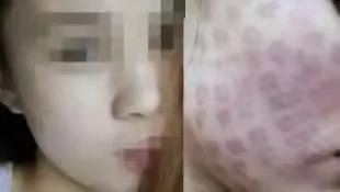 正规热玛吉和山寨的区别,热玛吉造假