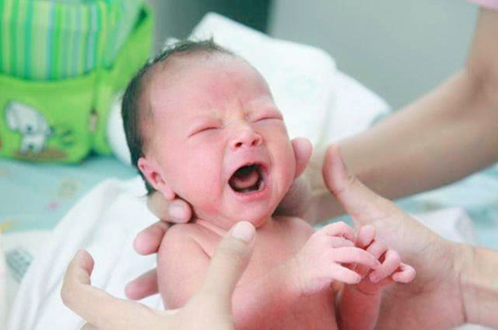 新生宝宝头发少怎么办,新生儿头发像秃顶啥原因