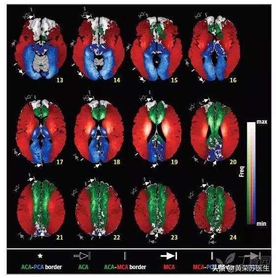 走进神秘的大脑世界：不同脑区损伤的临床表现（值得收藏）