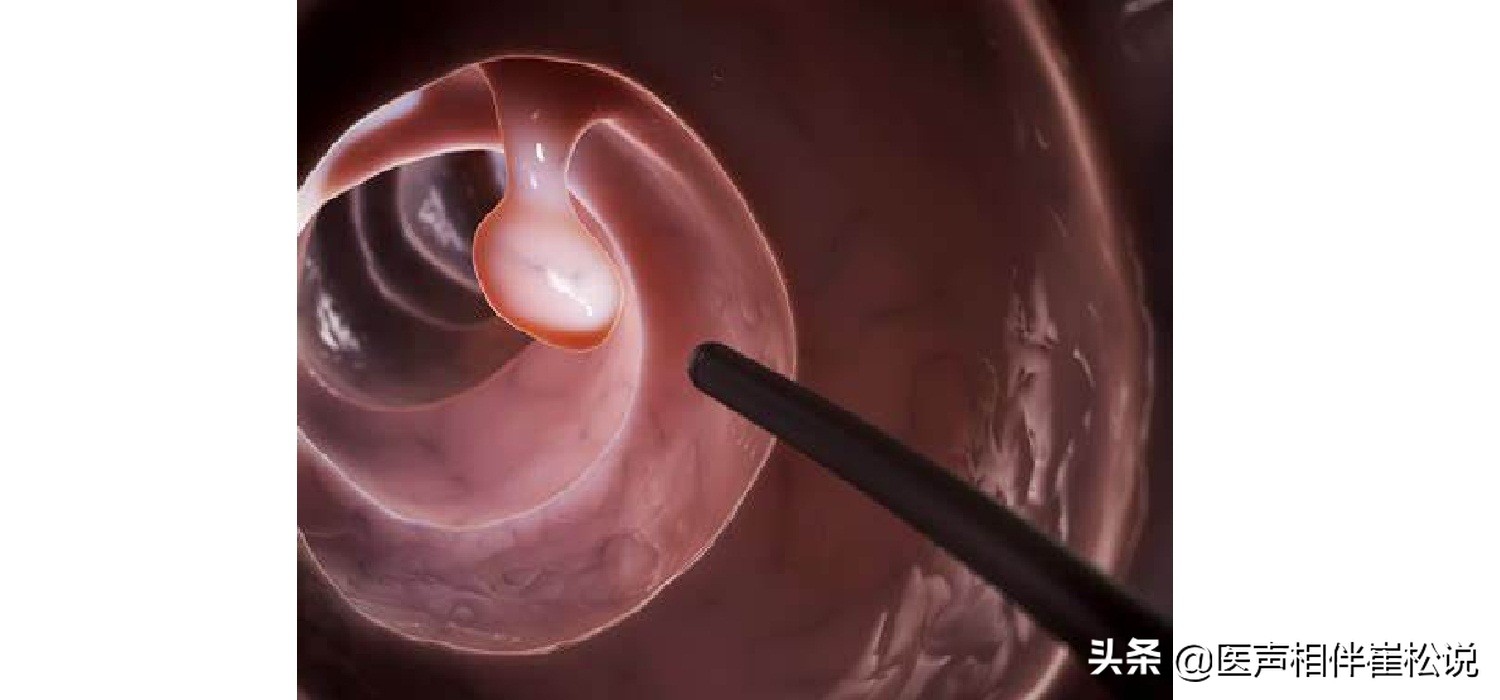 告别便秘的第一天,告别便秘的瑜伽动作