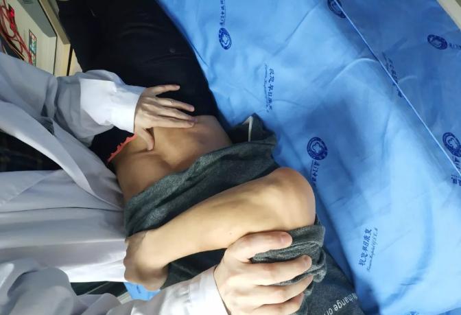 脊柱相关疾病治疗学,脊柱畸形看病经验分享