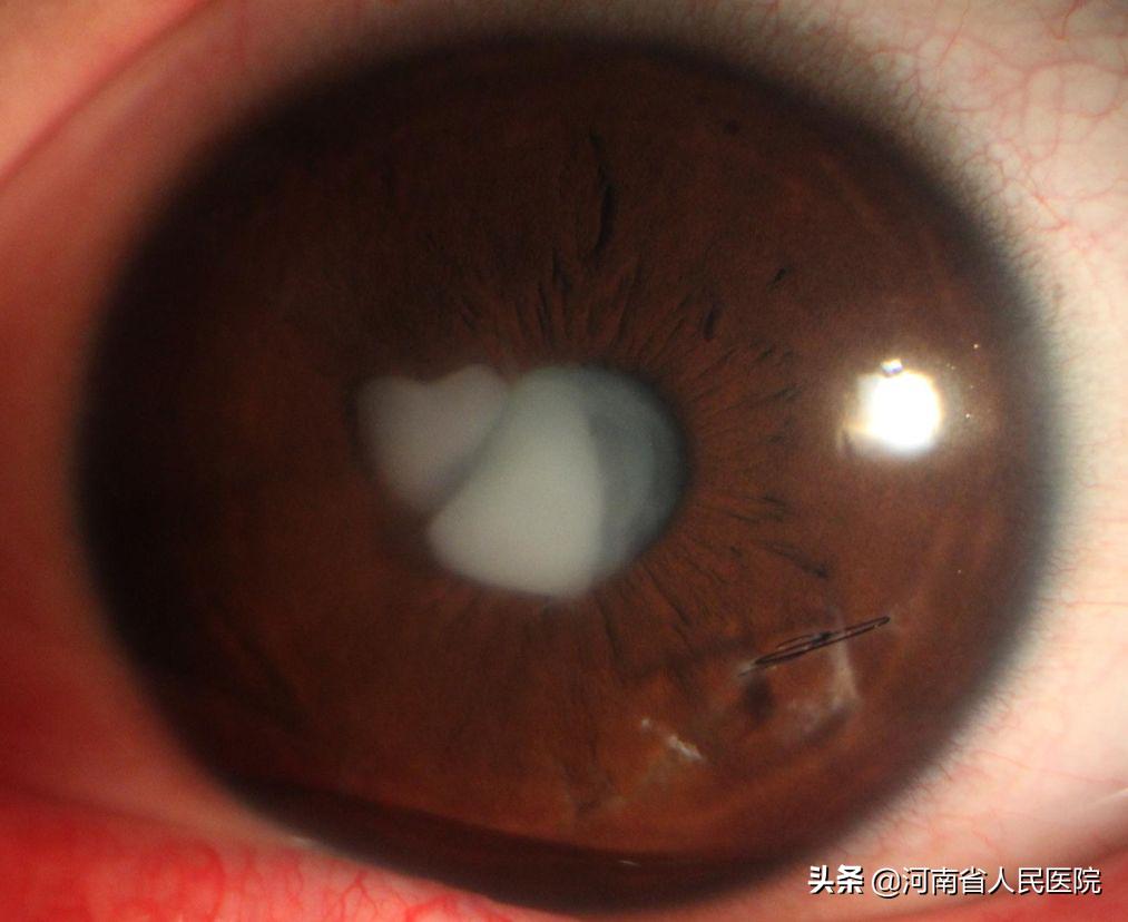 吃药杀病毒儿童,儿童杀病毒