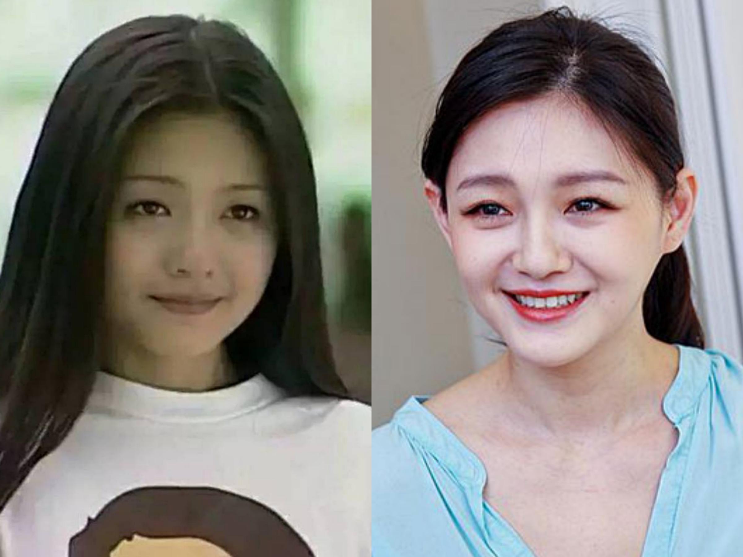 长期使用美容仪斑会淡吗,长期使用美容仪皮肤会提亮吗