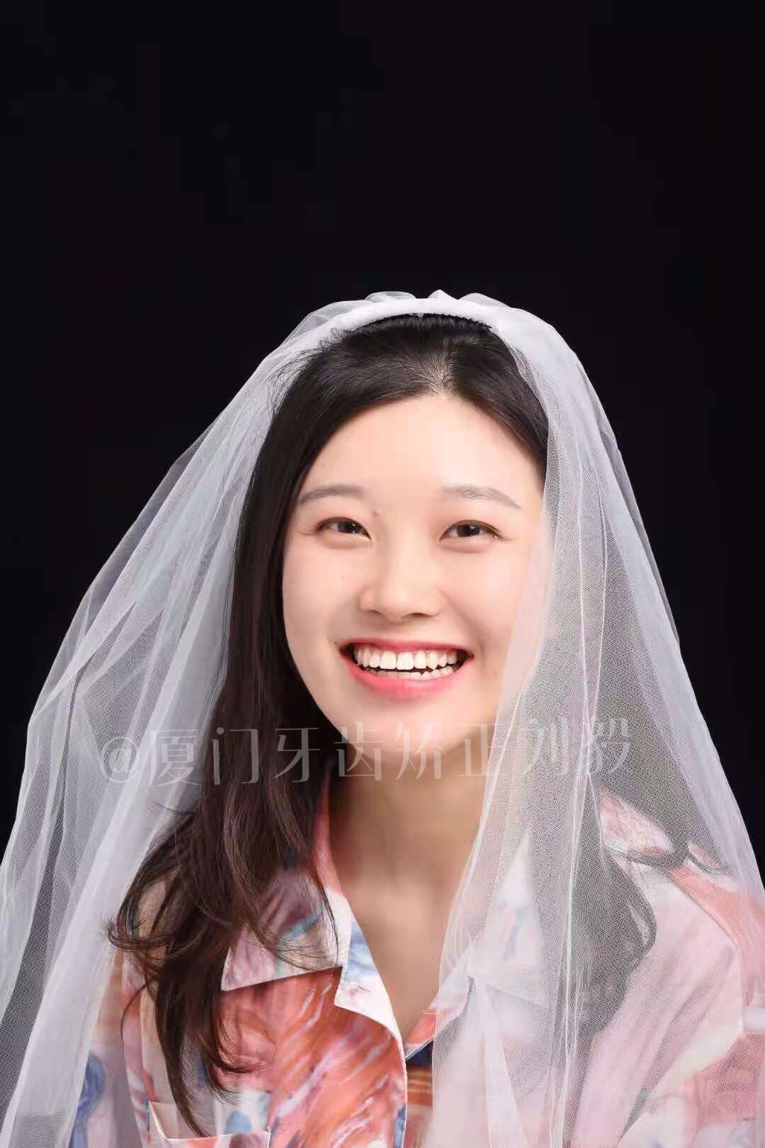 厦门牙齿矫正刘毅,厦门正畸刘毅