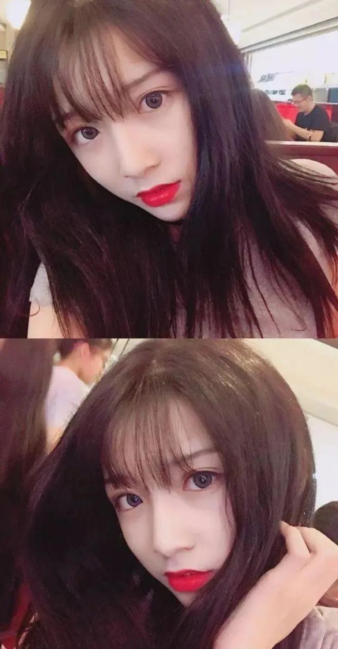 男子做变性手术当网红,艾比变性手术申请表