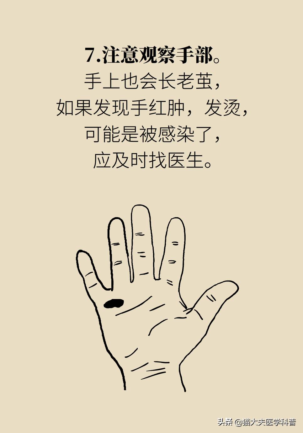 鸡眼好了长了一层老茧,鸡眼与老茧的区别图片