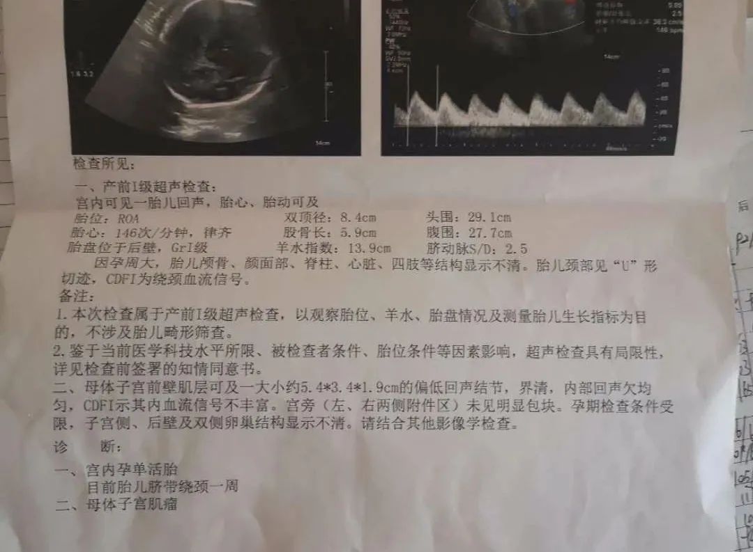 孕期复查胎儿侧脑室宽做什么b超,孕期一般做几个b超