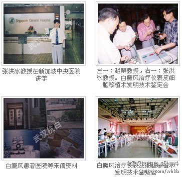 武汉治疗白癜风哪家医院实力强,湖北白癜风医院哪家治疗白癜风好