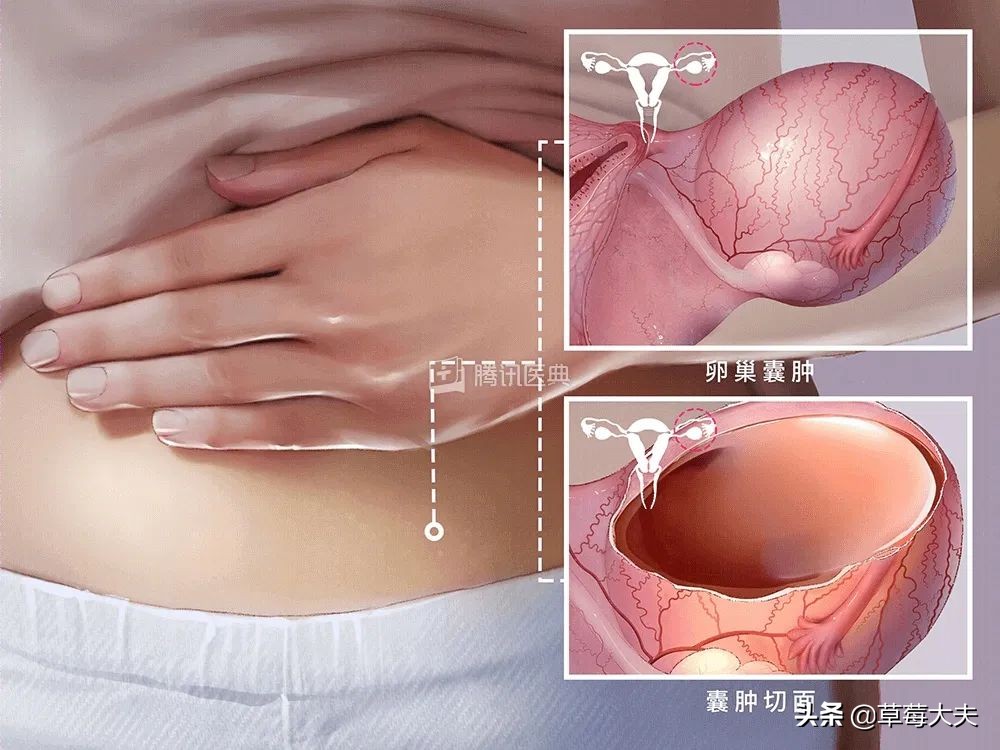 女孩腹痛难忍到医院,女童腹痛剧烈