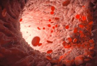 术后刀口流水怎么回事,胸腔镜术后刀口流水是什么原因