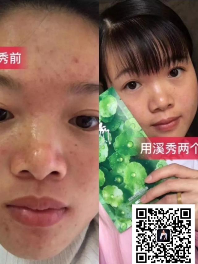 溪秀面膜补水,溪秀淡斑面膜