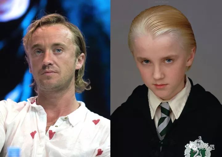 威廉王子秃顶了哈里为啥没秃顶,威廉王子为什么喜欢秃顶