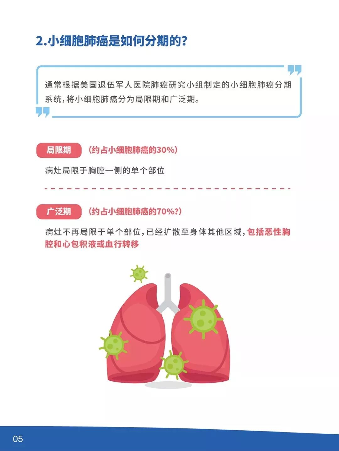 一文读懂小细胞肺癌