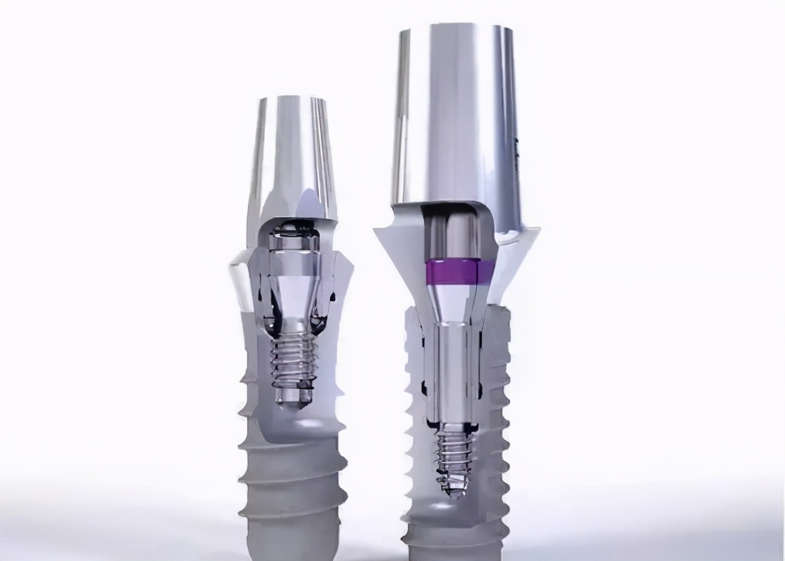 雅悦齿科种牙,雅悦齿科种植牙价格