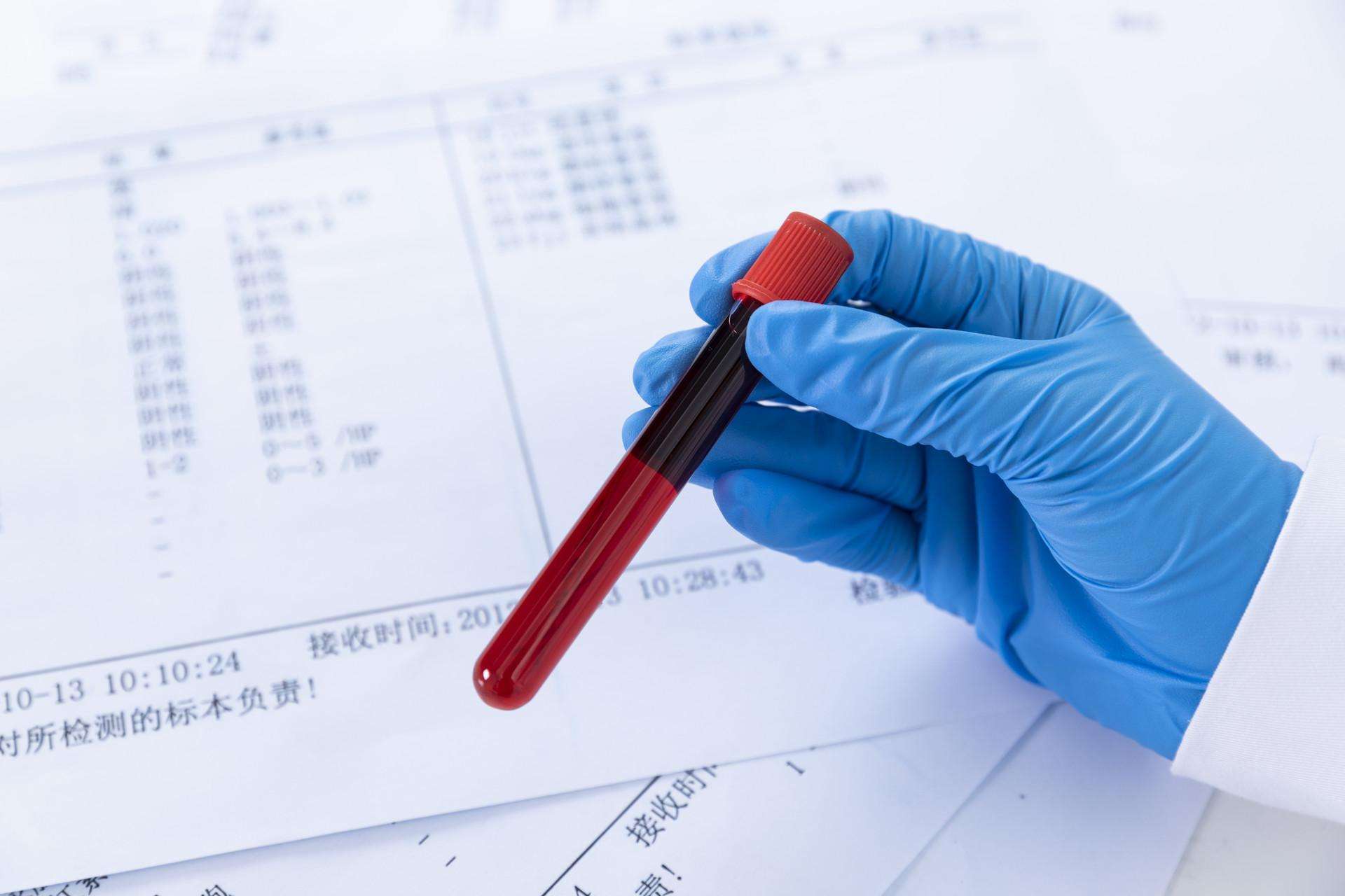 尿糖一般几个加号是糖尿病,尿糖跟糖尿病有什么区别