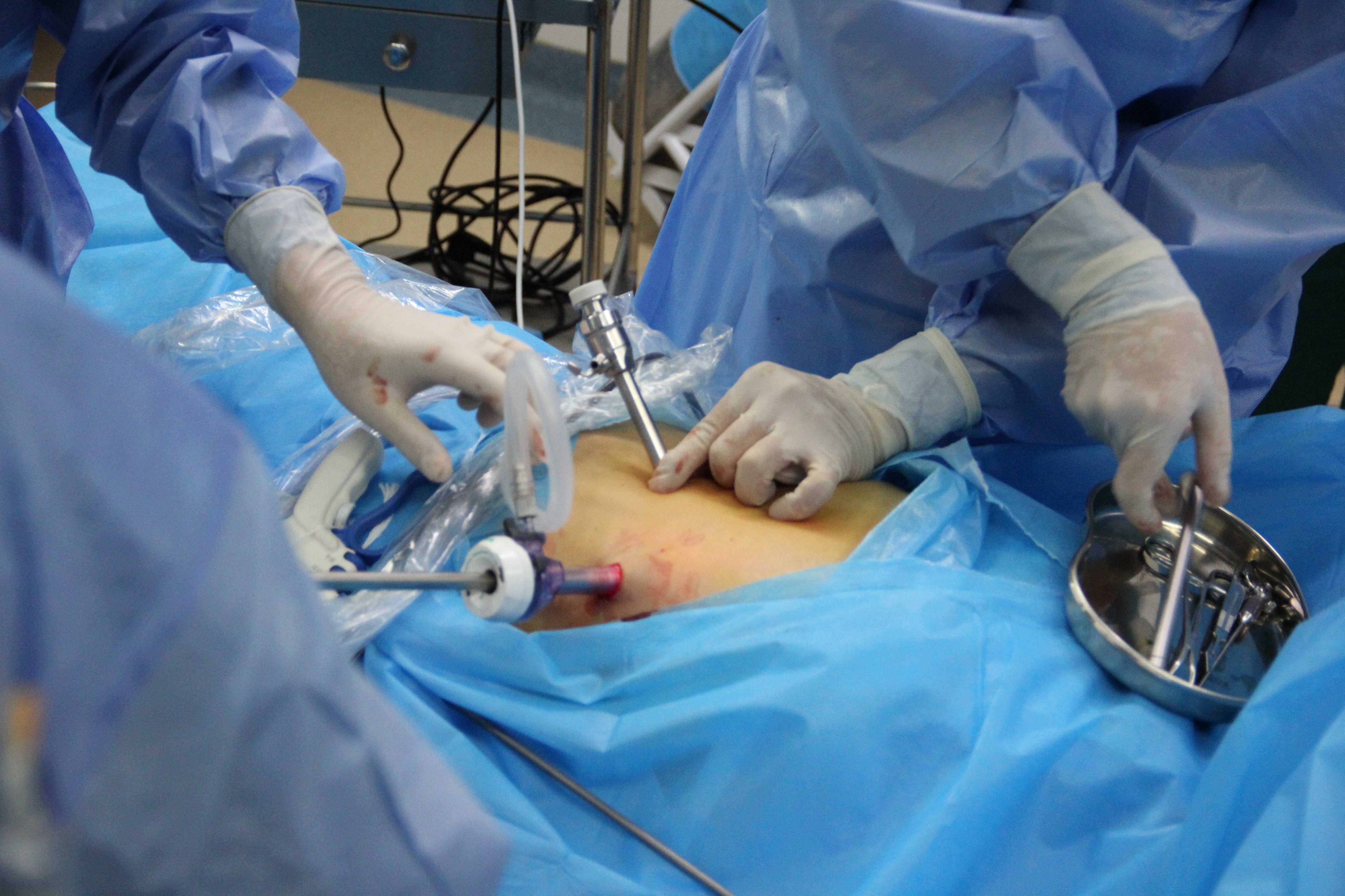 胃嗳气反酸能吃雷贝拉唑钠吗,打嗝胃胀吃雷贝拉唑有效果吗