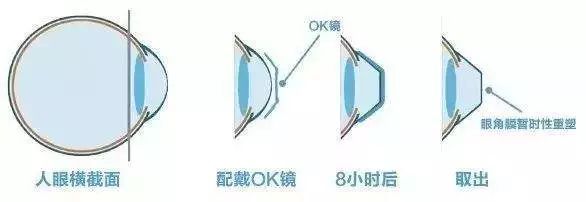 小孩歪头看电视的后果,儿童歪头看电视能好吗