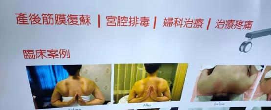 防妊娠纹霜什么时候用效果最好,防妊娠纹霜十大排名