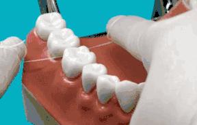 塞牙缝抠不出来没有牙线怎么办,塞牙用牙线刮不干净怎么办