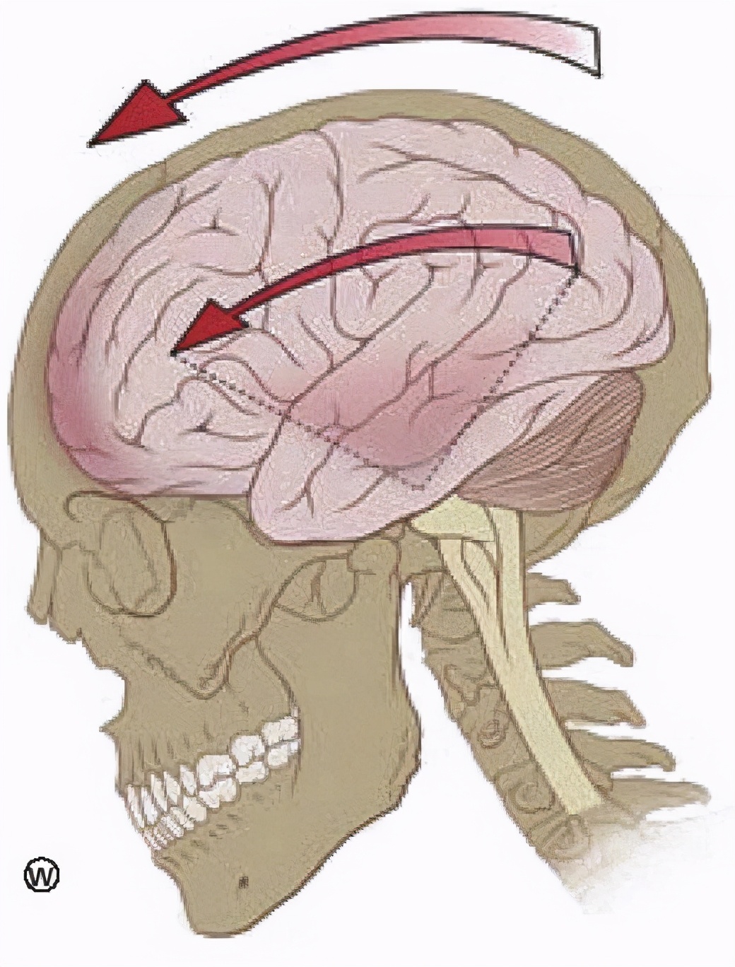 用头顶球会脑震荡吗,用头顶足球不会脑震荡吗