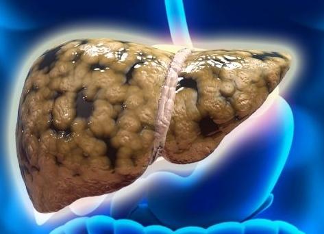 胆囊炎疼痛发作不治疗有什么危害,胆囊炎的症状及危害有生命危险吗