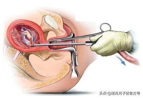 怀孕大肚子不小心摔倒了流产了,孕妇摔倒大出血流产古代电视剧