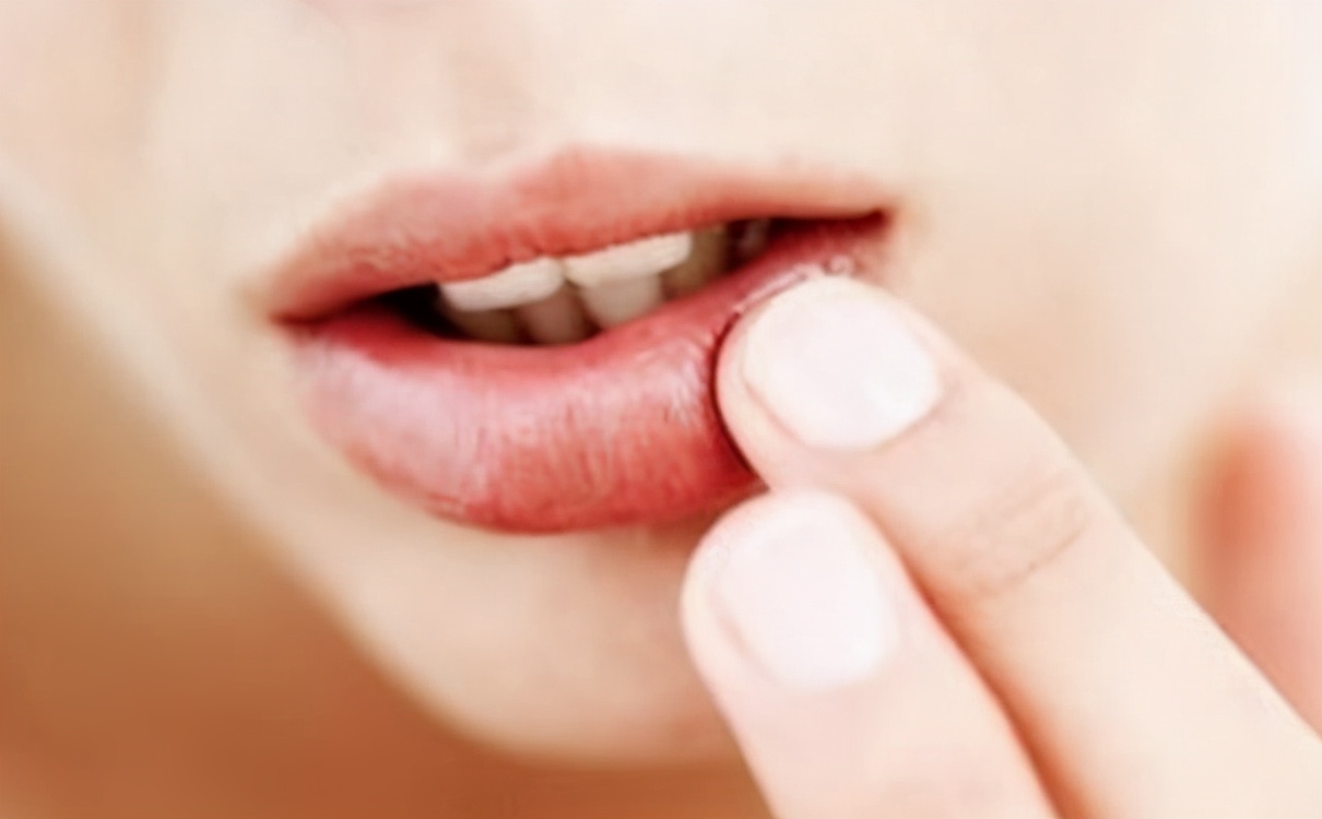 唇炎干裂脱皮怎么治,唇部干裂唇炎图片