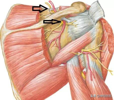 周围神经卡压解剖与分析,腓浅神经卡压解剖视频