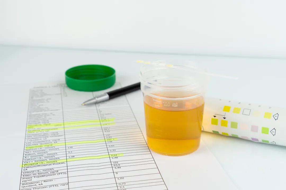 多饮多尿并非就是糖尿病，还可能...