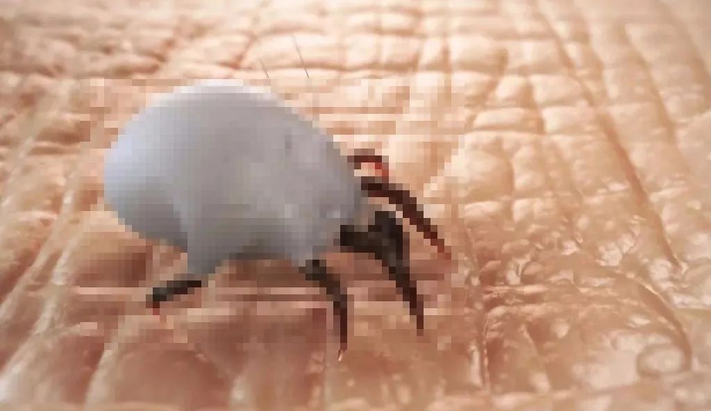 腋下痘痘挤出白色米粒是什么,痘痘里面挤出小米粒是不是就好了