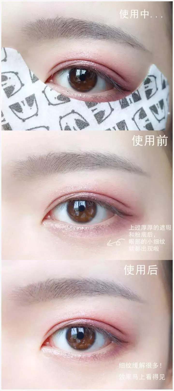 陆毅贝儿眼膜,陆毅用的眼膜