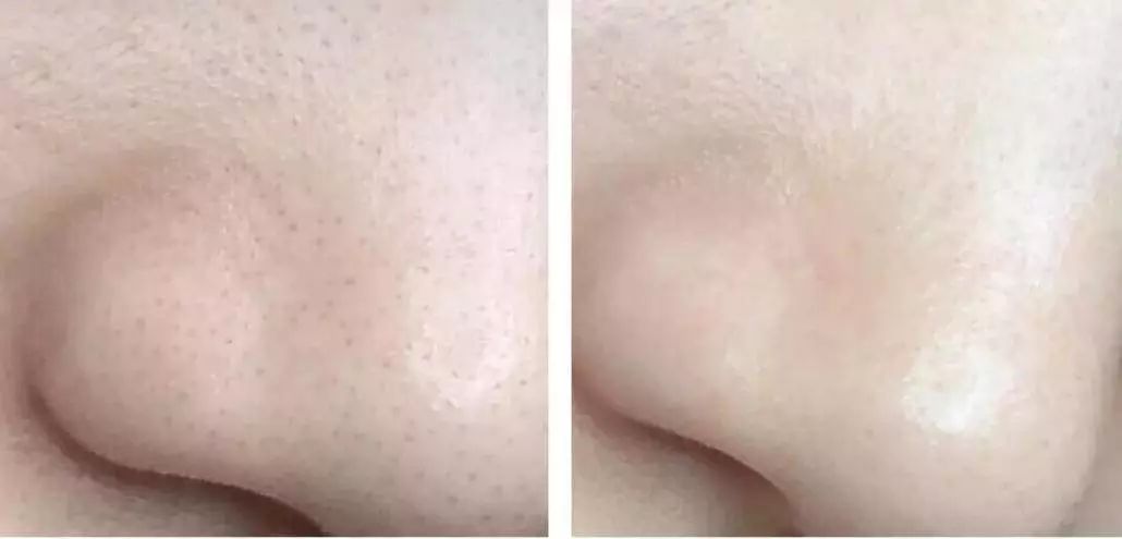 黑色撕拉式面膜去黑头推荐,超美的星空面膜