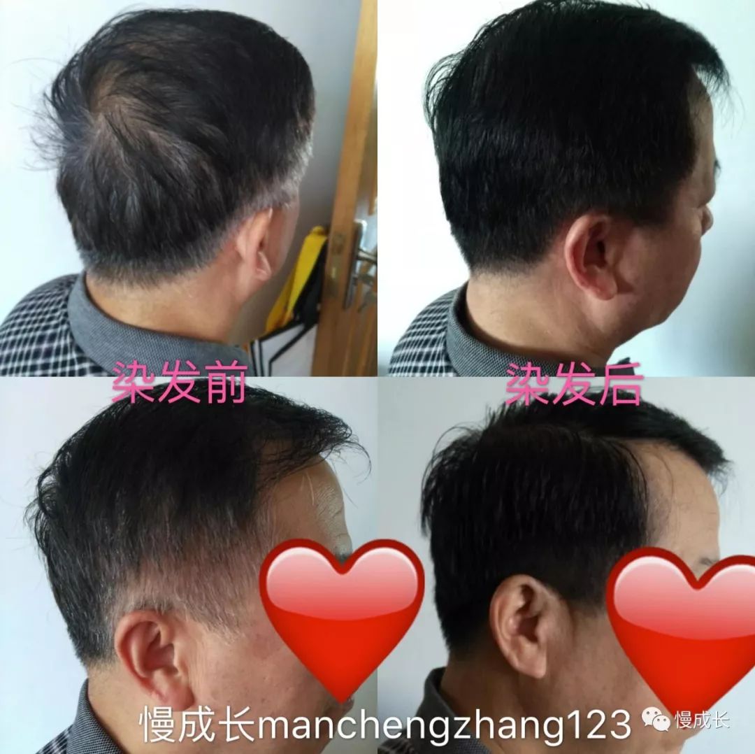 不带梳子款温和染发膏,有没有染发不沾头皮无害的染发膏