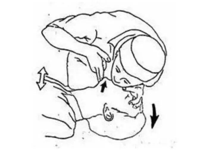 26岁医生猝死的真实原因,医学专家解读29岁女人猝死的原因