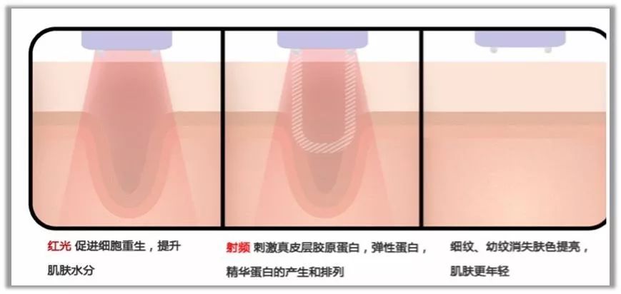 又是激凸又是露底，“蜜桃肌”的盛世美颜也有翻车时