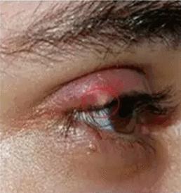 4岁女童身上有针眼,4岁女童遭穿刺后命丧手术台