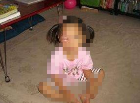 四岁孩子反复起针眼,5岁小朋友长针眼