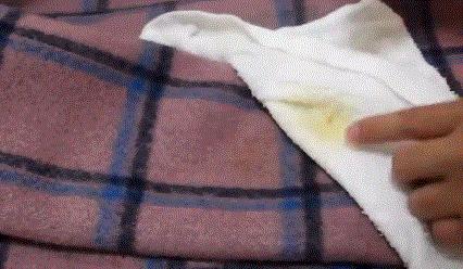 衣服上有霉斑怎么洗才能洗掉,衣服去霉斑最快最狠的几种方法